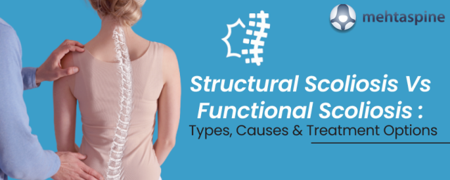 Structural Scoliosis Vs Functional Scoliosis : Overview