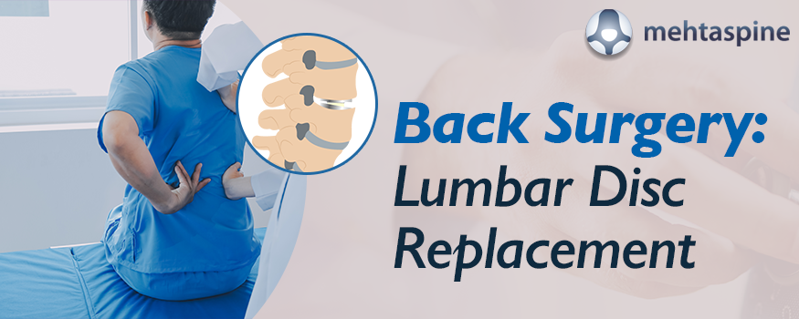 Back Surgery: Lumbar Disc Replacement